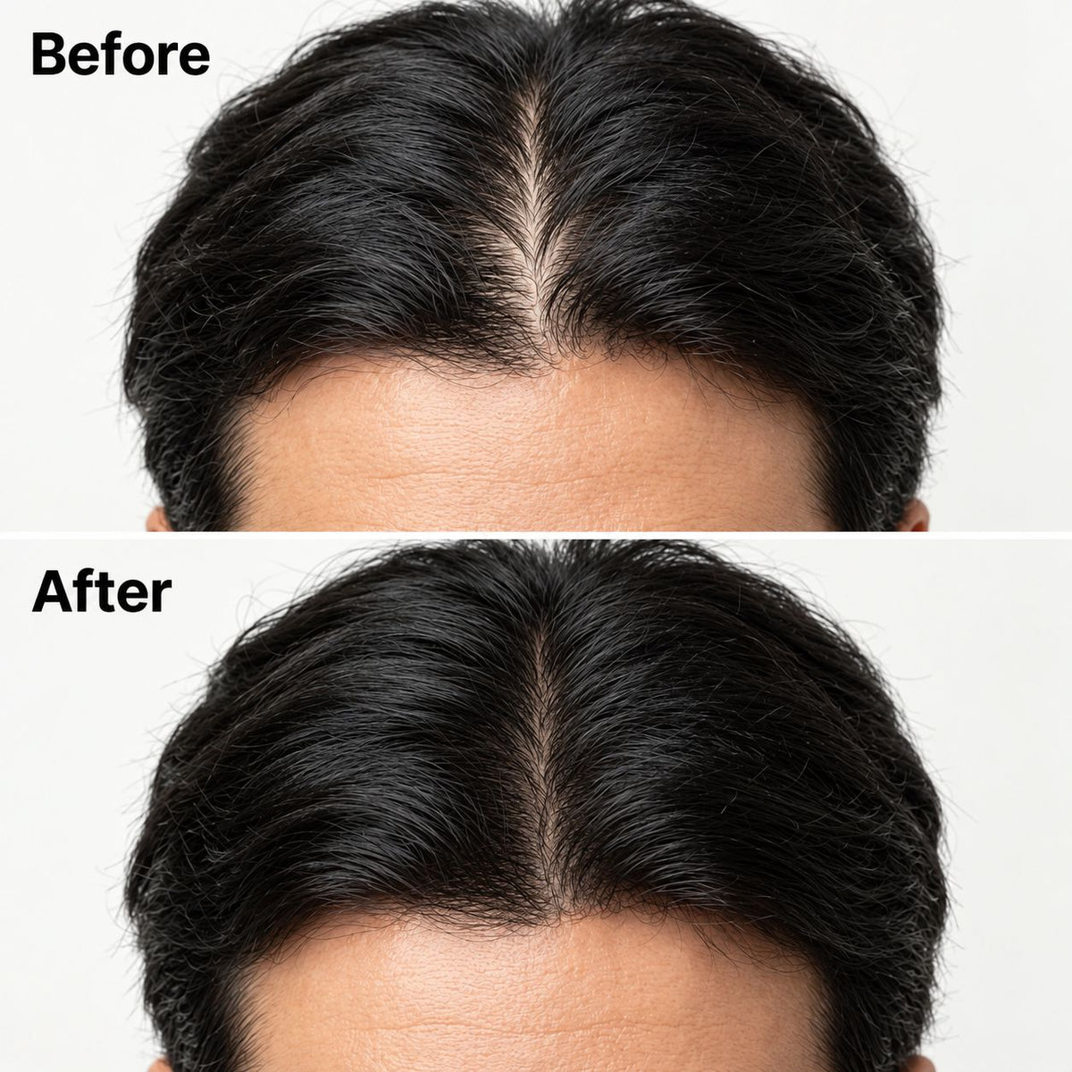 Korean Scalp Revival Bar