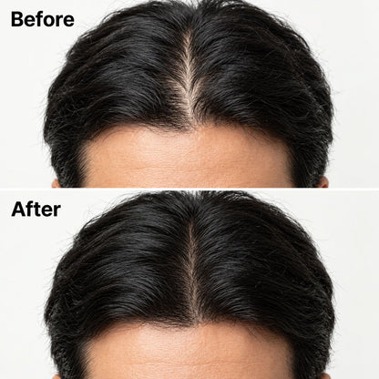 Korean Scalp Revival Bar